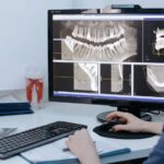 are dental x-rays safe
