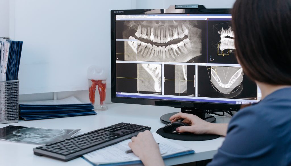 are dental x-rays safe