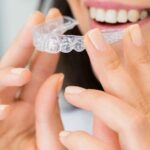 benefits of clear aligners & invisalign