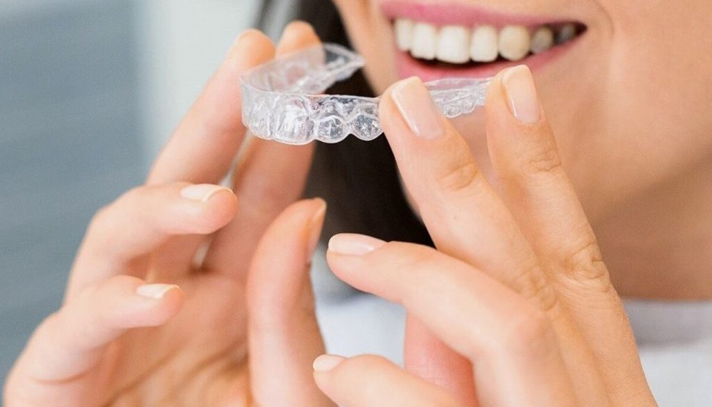 benefits of clear aligners & invisalign