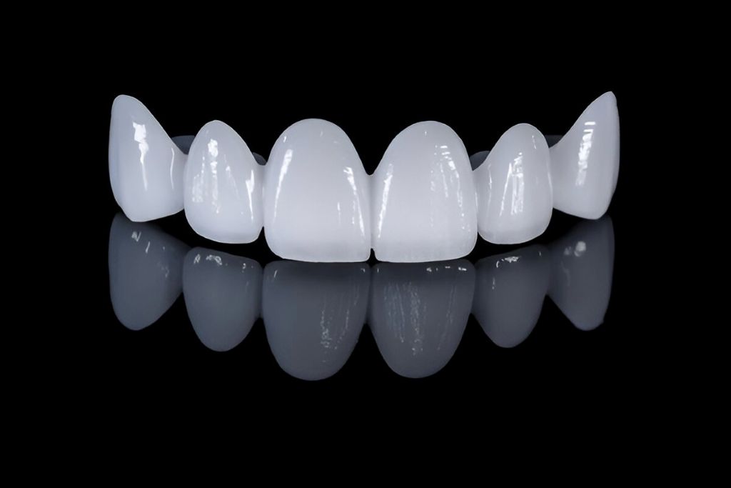 dental bridges near you