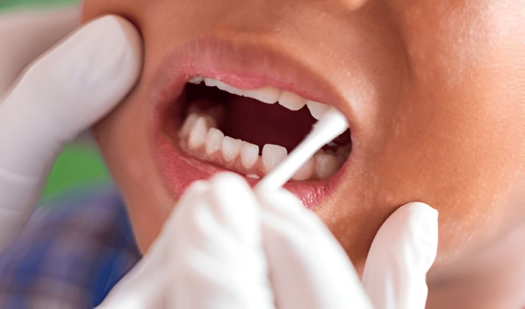 fluoride treatments near you