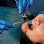 what is an oral cancer screening?
