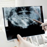 why oral cancer screening is so important