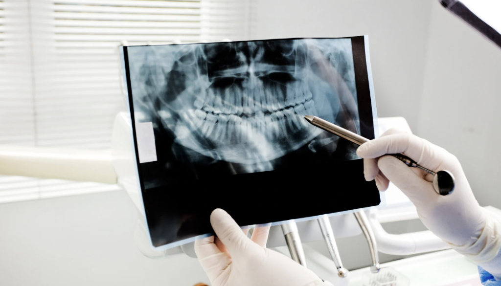 why oral cancer screening is so important