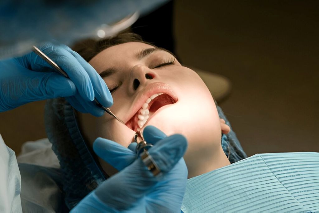 wisdom teeth removal In surrey, bc