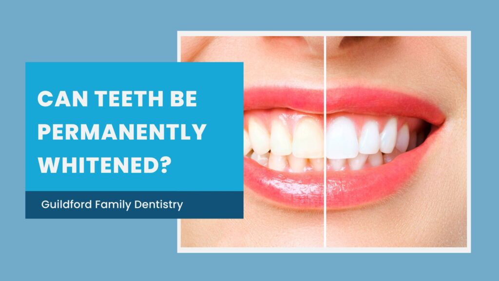 can teeth be permanently whitened?