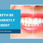 can teeth be permanently whitened?