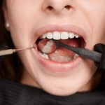 do you really need a root canal signs you shouldn’t ignore
