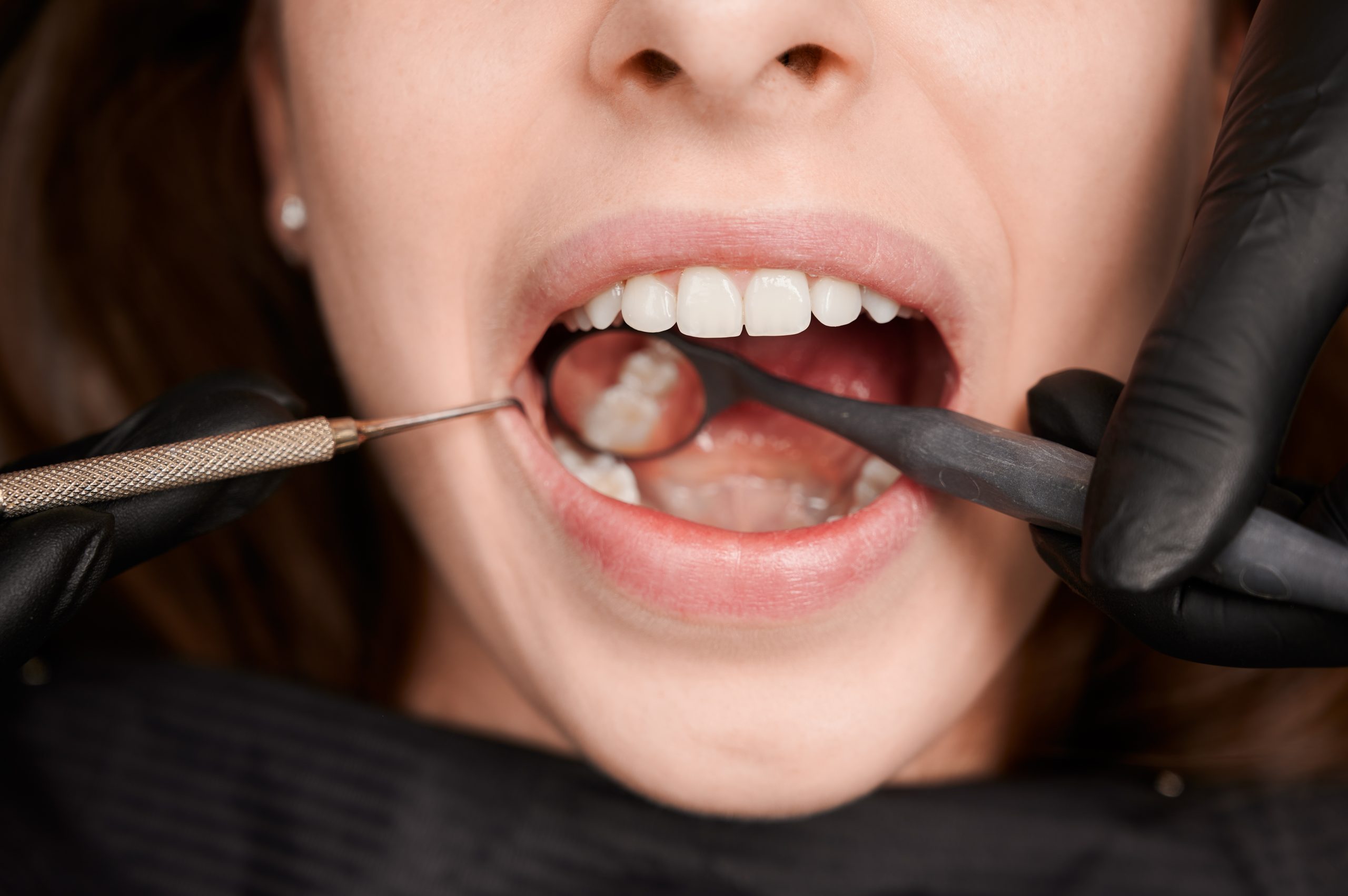 do you really need a root canal signs you shouldn’t ignore